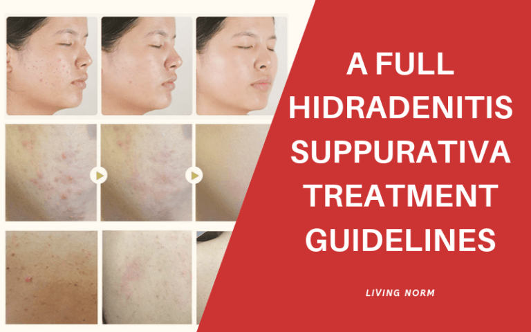 A Full Hidradenitis Suppurativa Treatment Guidelines